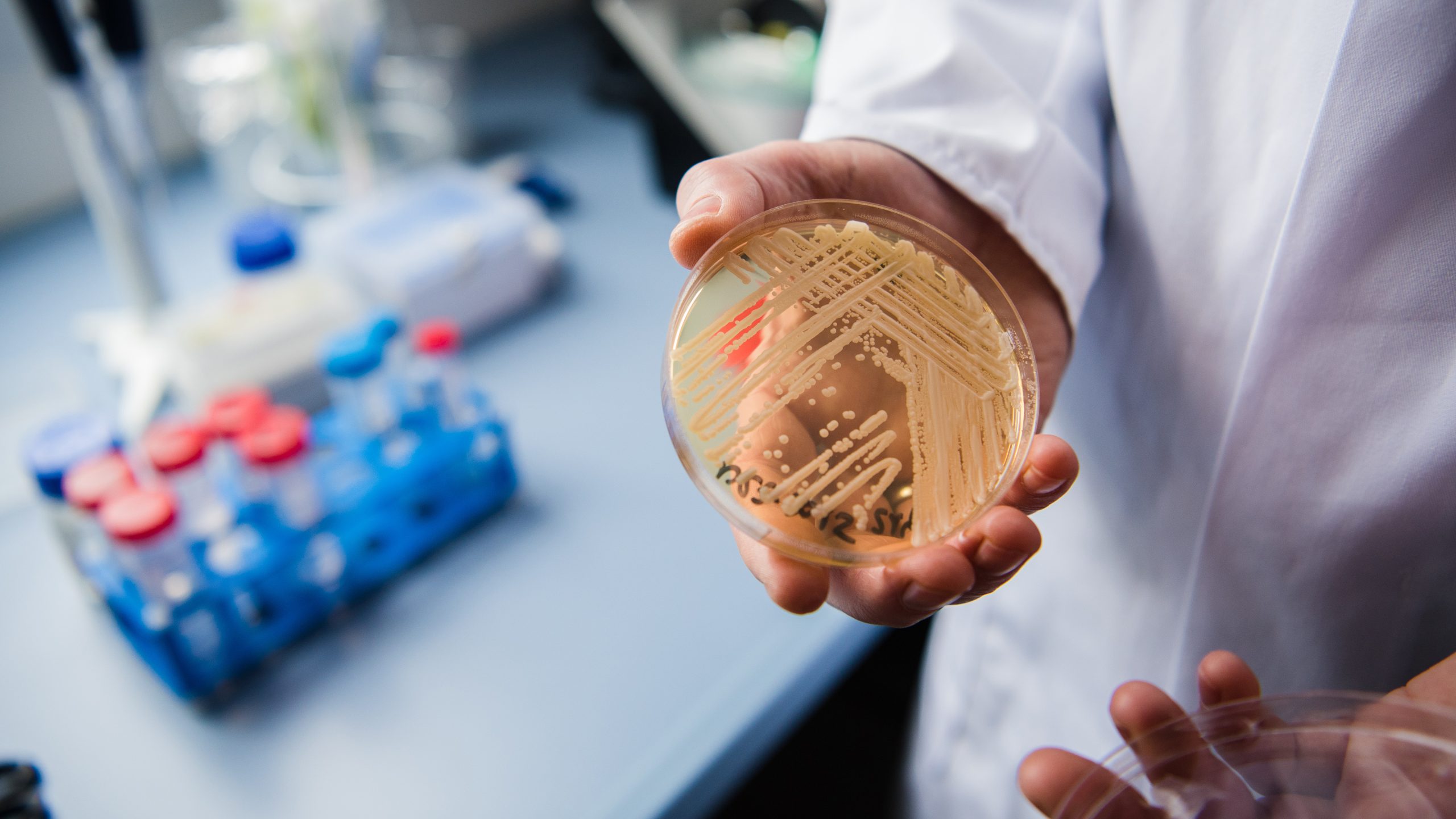 New study reveals why dangerous fungus is so difficult to treat — KTVU FOX 2 Bay Area, Portola Valley Community news